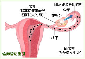 输卵管伞端粘连为何会导致不孕呢